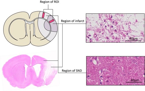 Figure 1 Define regions of interest (ROIs). Schematic drawing of infarction and SND area, pink sliver indicate ROIs, the ROIs – cortical columns 0.5 mm in width – were placed perpendicular to the cortical surface which correspond to 5.7 mm left of the midline, where normal tissue developed infarction (right, above), and 2.5 mm left of the midline, where selective neuronal death (right, below) was consistently observed 2 w after ischemia. Bar scale=40 µm.