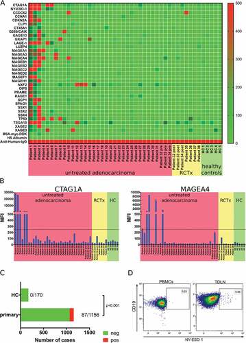 Figure 4. Analysis of the tumor antigen-specific B cell response in gastro-esophageal adenocarcinoma. LUMINEXTM analyses of 34 TAAs were performed in serum samples of untreated gastro-esophageal adenocarcinoma patients (n = 34), serum samples following neoadjuvant chemoradiotherapy (n = 7) and healthy controls (n = 5) was analyzed by LUMINEXTM (A). Individual MFIs for CTAG1A and MAGEA4 (B). Summary of antibody responses detected in serum samples of tumor patients and healthy controls (C) Exemplary flow cytometry analyses of b cells specific for NY-ESO-1 (CTAG1A) in PBMC and TDLN of a gastro-esophageal adenocarcinoma patient using biotinylated NY-ESO-1 and a streptavidin tetramer (D). Heatmap and bar graphs of LUMINEXTM data show mean MFIs of duplicates, p = ChiCitation2 test.