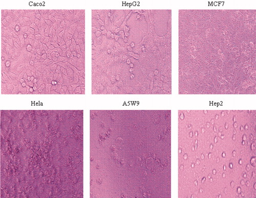 Figure 2. Pictures of Caco2, HepG2, MCF7, Hela, A5W9 and Hep2 cell lines before inhibition.