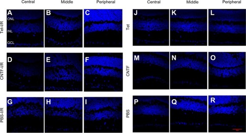 Figure 6 Tet protects RGCs from ischemic injury in vivo.