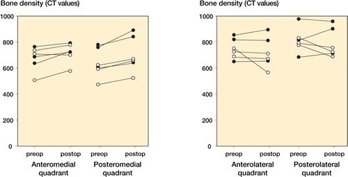 Figure 24. Bone density in zone 1 of the medial and lateral quadrants of the acetabulum just after periacetabular osteotomy and 2 years postoperative. Three patients had a preoperative degree 2 osteoarthritis, and they are marked with a black dot. The other three patients had a preoperative degree 0 osteoarthritis and are represented with a white dot.