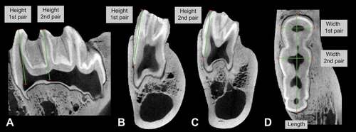 Figure 2. Lower third molar measurements taken on CT scans of extant Hylochoerus. The specimen pictured is the right lower third molar of ZMB 83342 in A) sagittal, B-C) coronal, and D) transverse planes