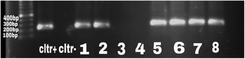 Figure 1 Gel electrophoresis for PA431C gene to determine the prevalence of P. aeruginosa. The band size was 232 bp. Samples 5–8 were positive, whereas 3 and 4 were negative clinical samples.