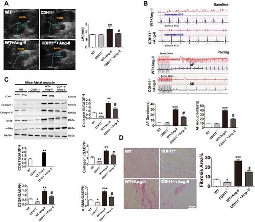 Figure 6 Loss of CDH11 alleviated LA remodeling and susceptibility to atrial fibrillation in Ang-II-infused mice. Both WT and CDH−/- mice were received continuous infusion of saline or Ang-II (1 μM) for 28 days. (A and B) On the 28th day, the mice were received echocardiography exams (A) for measurement of LA dimension and electrophysiological studies for surface and intra-cardiac ECG tracings (B). (C and D) Representative images and bar graph summaries of Western blotting for ECM protein levels (C) and picrosirius red staining for collagens (D) of the LA tissues. Bar=100 μm; N=6 animals for each group. Data are presented as mean ± SD. *: p<0.05, **: p<0.01, ***: p<0.001 vs WT. #: p<0.05 vs WT+Ang-II.