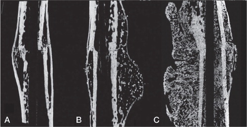 Figure 3. Micro-CT rendered image of median samples from each group (based on callus volume). A. Autograft. B. Autograft + BMP. (C) Autograft + BMP + zoledronate.