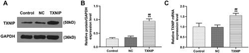 Figure 5. Overexpressed TXNIP plasmid was successfully transfected into HUVECs. (A, B) The transfection efficiency was determined by western blot. (C) The transfection efficiency was determined by qRT-PCR. GAPDH was used as the internal control. All experiments were performed in triplicate and the experimental data were expressed as mean ± standard deviation (SD) (**p< 0.01, vs. control; ##p< 0.01, vs. NC). HUVECs: human umbilical vein endothelial cells; TXNIP: thioredoxin-interacting protein; NC: negative control.