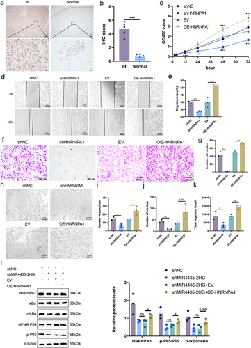 Figure 7 HNRNPA1 expression is elevated in IHs and regulates biological function of HemECs in vivo. (a and b). IHC staining and scoring of HNRNPA1 in IHs and normal tissues; (c). Cell proliferation capacity assessed by CCK-8 assay; (d and e). Wound healing assay used to examine the migration rate of HemECs; (f and g). Use of Transwell chambers to assess invasive capacity of HemECs and to count the number of cells passing through the chambers membrane; (h–k). Representative images of tube formation assays and statistics of the number of junctions and meshes and total segments length; (l). Representative images (left) and histograms (right) of Western blotting of HNRNPA1 expression and NF-κB signaling pathway molecules in HemECs (Student’s t-test, *P < 0.05, **P < 0.01, ***P < 0.001, ns, nonsignificant).