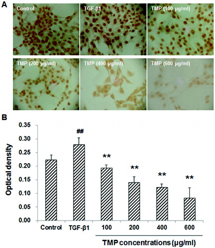 Figure 5. Effects of TMP on TGF-β1-induced Smad2/3 expression in HSC-T6 cells detected by immunocytochemistry. (A) Immunocytochemistry was performed to detect Smad2/3 expression in HSC-T6 cells after drug administration (DAB staining, ×200). (B) Quantitative analysis of the average optical density of Smad2/3 staining in the nuclei in HSC-T6 cells. n = 6; compared with the control group, ##P < 0.01; compared with the TGF-β1-treated group, **P < 0.01.
