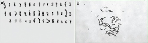 Figure 5 Analysis of Karyotype.