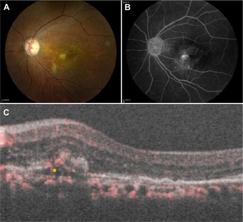 Figure 3 Clinical imaging for Case 3.