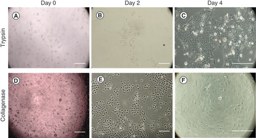 Figure 4. Human corneal endothelial cell isolation using trypsin and collagenase.At day 0, (A) the cells digested with trypsin presented smaller cell number compared with (D) collagenase. At day 2, (E) the cells digested with collagenase showed better proliferation than the cells digested with (B) trypsin. At day 4, (F) nearly 50–70% confluence was found in the collagenase group. Meanwhile, (C) around 30–40% cell confluence was found in trypsin group. Scale bar = 250 μm.