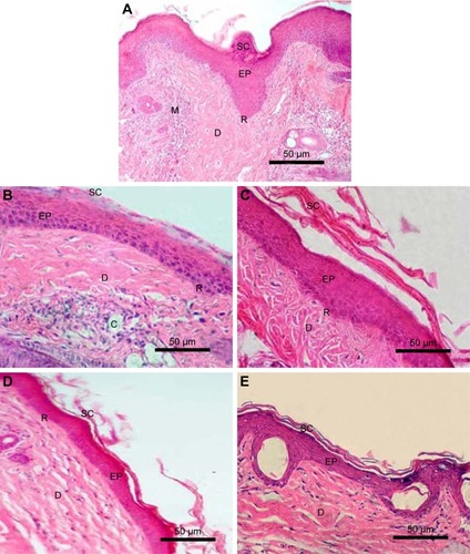 Figure 11 Photomicrographs of histopathologic examination of mouse tail skin after topical application of different gel formulations for 4 weeks.Notes: (A) Control tail skin, (B) plain gel, (C) zarotex gel, (D) Act gel, and (E) Act niosomal gel. H&E (100×).Abbreviations: Act, Acitretin; C, blood capillaries; D, dermis; EP, epidermis; M, Munro abscess; R, rete ridges; SC, stratum corneum.