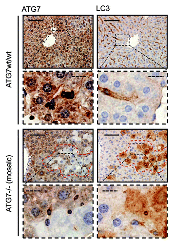 Figure 3. Detection of a punctate LC3-staining pattern in murine wild-type liver and uniform staining in atg7−/− tissue. Immunohistochemical staining for ATG7 and LC3 in murine wild-type liver (top two rows) and consecutive liver sections with mosaic deletion of ATG7 (atg7−/−, bottom two rows). Panels with straight borders are complete, i.e., not cropped and representative overview images taken at 40x magnification with a scale bar (straight) that represents 100 µm. Panels with dashed borders are cropped sections from the overview panels (cropped regions are indicated by the small dashed rectangle). The dashed scale bars in the zoomed and cropped panels represent 20 µm. IHC was done on consecutive sections for the atg7−/− samples and a landmark region with mostly recombined (i.e. ATG7-deficient) cells is encircled with red dashes. Antigen retrieval for LC3 was undertaken in Tris-EDTA, pH 9 and at 10 mM Na Citrate buffer, pH 6 for ATG7.