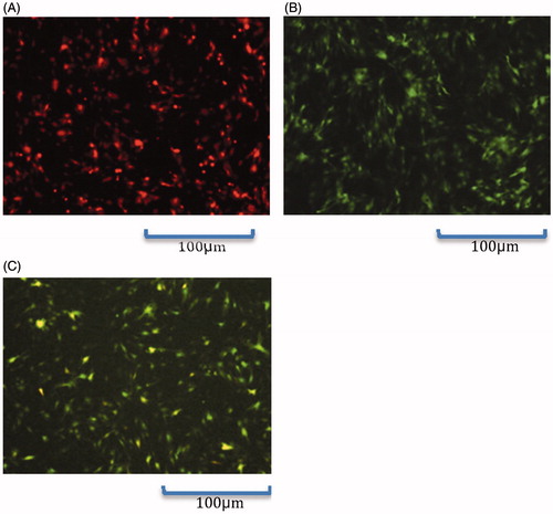 Figure 1. Fluorescence microscopic observation of C3H10T1/2 cells 48 h after infection (100×). (A): Ad-VEGF165 group; (B): Ad-BMP2 group; (C): Ad-VEGF165 + Ad-BMP2 group.