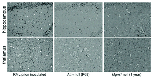 Figure 1. Histologically similar spongiform degeneration of the CNS with a similar anatomical distribution is observed in RML prion-inoculated mice and mice lacking ATRN or MGRN1. Top row: CA3 region of hippocampus; bottom row: thalamus.