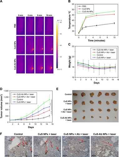 Figure 6 Thermal imaging and anti-tumor efficacy of PTT in vivo for 4T1 xenograft tumor mice.Notes: (A) Representative thermal images of tumor under irradiation laser (0.2 W/cm2, 10 minutes) after treatment with CuS NPs and CuS-Ab NPs. (B) Rising temperature curve of tumor in live mice after treatment with CuS NPs and CuS-Ab NPs. The control group was treated with PBS. (C) The weight of the mice was monitored every other day. (D) Tumor volume curve of xenograft tumor mice over 2 weeks. The tumor volume was calculated from the length and width of the tumor, obtained from live mice every other day. (E) Representative tumor images were obtained from live mice in different groups with or without treatment. (F) Immunohistochemistry staining of CD31 in tumor. The red arrow indicates CD31 in endothelial vessels. All data represent mean values (n=6). **P<0.01.Abbreviations: CuS NP, CuS nanoparticle; CuS-Ab NP, cetuximab-modified CuS NP; PTT, photothermal therapy.