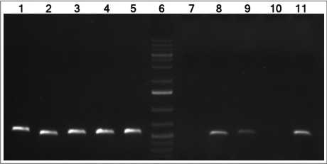 Figure 1. cDNA amplification of genes from the A1S_0242–0244 operon of A. baumannii ATCC 17978 strain. The intergenic regions from genes A1S_0242–0243 and A1S_0243–0244 are shown in lanes 8 and 9, respectively. The intergenic regions from genes A1S_0241–0242 and A1S_0244–0245 are shown in lanes 7 and 10, respectively (negative controls). Genomic DNA was used as template for positive control (lanes 1 to 5, respectively). Lanes 5 and 11 show the gyrB amplification from DNA and cDNA, respectively (positive controls). Lane 6 shows GeneRuler 1 Kb Plus DNA Ladder (Thermo Fisher Scientific).