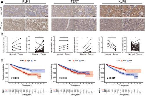 Figure 10 The expression of 3 necroptosis-related genes between KIRC and adjacent non-tumor tissues. (A) The protein expression analysis by IHC. (B) Immunoreactivity scores and mRNA levels from TCGA between tumor and normal issues. (C) Survival analyses of 3 necroptosis-related genes. *P< 0.05 and **P< 0.01.