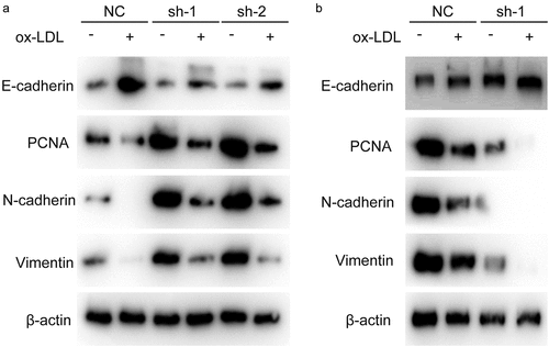 Figure 3. Hsa_circ_0001879 promotes the expression of PCNA and EMT progress. Cells with indicated modification was collected and subjected to immunoblotting, PCNA and EMT markers were measured