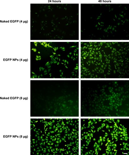 Figure 3 In vitro transfection efficiency of EGFP-loaded NPs.Notes: Free EGFP and EGFP-loaded nanoparticles (NPs) were incubated with cells for 24 and 48 hours. In vitro transfection efficiency of EGFP-loaded NPs was evaluated by the change on the intracellular green fluorescence intensity. The scale bar is 50 μm and applies to all figure parts.