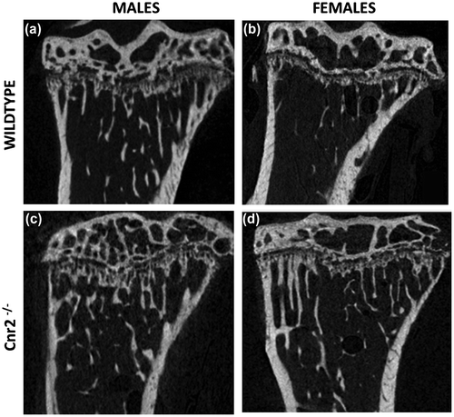 Figure 2. 2D representative micro-CT images of trabecular bone from a tibia of (a) 12-week-old WT male mouse, (b) WT female, (c) Cnr2-/- male and (d) Cnr2-/- female.
