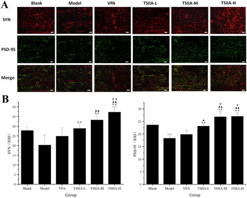 Figure 5. Immunofluorescence study of tanshinone IIA's effect on hippocampus SYN (red) and PSD-95 (green) expression. (A) Single and double fluorescence staining (×400, scale bar: 50 μm). (B) Immunofluorescence expression results of SYN and PSD-95 were counted and analysed with Image-Pro Plus 6.0 software. Results are presented as mean ± SEM. Δp < 0.05, ΔΔp < 0.01 vs. blank; **p < 0.01 vs. model; ▲p < 0.05, ▲▲p < 0.01 vs. VPA; #p < 0.05, ##p < 0.01 vs. TS IIA-L (n = 6 per group).