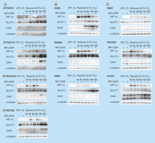 Figure 2.  Effect of AKT inhibition on hypoxia inducible factor 1 signaling under hypoxic conditions.Expression of HIF-1α and downstream proteins GLUT-1 and CAIX after incubation with hypoxia (0.5% O2) with or without AKT inhibition (2 μM MK-2206) in (A) four HNSCC; (B) three squamous cell carcinoma NSCLC and (C) three adenocarcinoma NSCLC cell lines. α-tubulin was used as loading control.CAIS: Carbonic anhydrase IX; GLUT-1: Glucose transporter-1; HNSCC: Head and neck squamous cell carcinoma.