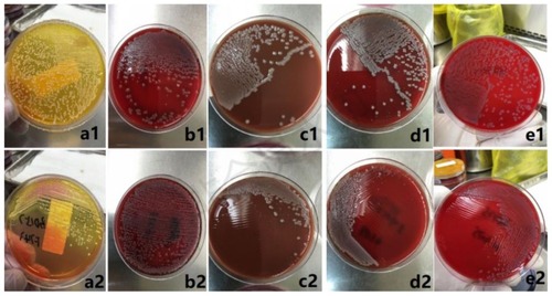 Figure 1 The isolated single colonies on plates inoculated with the automated and manual methods. Feces specimen inoculated onto xylose-lactose-desoxycholate agar with BD Kiestra lnoqulA automated method (a1) and manual method (a2)；urine specimen inoculated onto Columbia blood agar with BD Kiestra lnoqulA automated method (b1) and manual method (b2); sputum specimen inoculated onto vancomycin-containing chocolate agar with BD Kiestra lnoqulA automated method (c1) and manual method (c2); sputum specimen inoculated onto Columbia blood agar with BD Kiestra lnoqulA automated method (d1) and manual method (d2); sterile body fluids specimen inoculated onto Columbia blood agar with BD Kiestra lnoqulA automated method (e1) and manual method (e2).