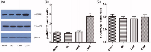 Figure 4. Effects of metformin on p-AMPK and T-AMPK expressions in the kidney after 45 min of ischemia followed by 12 weeks of reperfusion. (A) Representative Western blots showing the effects of metformin on p-AMPK and T-AMPK, (B) relative band densities of p-AMPK to the mean value of the control, (C) relative band densities of T-AMPK to the mean value of the control (*p < 0.05 versus the sham group, #p < 0.05 versus the IRI group. n = 5).