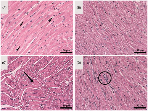 Figure 7. Optical microscopy images of heart tissue of: (A) control tumour-bearing mice (received vehicle only, which consisted of an aqueous solution of glucose 5% w:v), (B) mice treated with nanocapsules of selol (NCS), (C) mice treated with doxorubicin alone (DOX), and (D) mice treated with nanocapsules containing selol and doxorubicin (NCS-DOX). Arrows in A indicate parallel muscle fibers and the perpendicular intercalated discs. The arrow in C indicates wavy muscle fibers. The circle in D shows inflammatory infiltrate. Classical staining with hematoxylin and eosin was used.