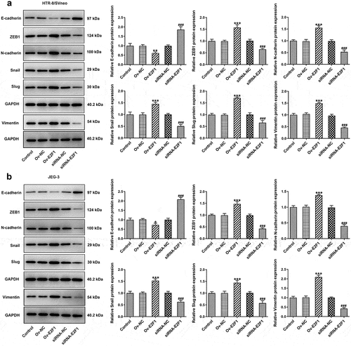 Figure 3. E2F1 activates EMT process of trophoblast cells. HTR-8/SVneo and JEG-3 cells were transfected with Ov-E2F1 or siRNA-E2F1. (a, b) Western blot assay for determination of E-cadherin, ZEB1, N-cadherin, snail, slug and vimentin expressions. *p < 0.05, **p < 0.01, ***p < 0.001 versus Ov-NC, ###p < 0.001 versus siRNA-NC.