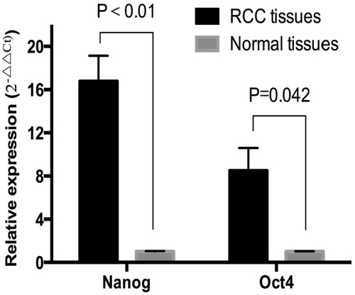 Figure 1. Nanog and Oct4 mRNA expressions in RCC and paracancerous tissues detected by real-time fluorescent quantitative PCR (n=86).