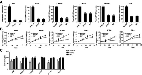 Figure 2 Effect of BANCR overexpression on NSCLC cell viability. (A) The expression of BANCR in each NSCLC cells transfected with BANCR expressing vector and empty plasmid was measured by real-time PCR. (B) The cell viability of six NSCLC cells was measured by CCK-8 assay at 0, 24, 48, and 72 hrs post transfection. (C) At 48 hrs post transfection, the cell proliferation of NSCLC cells expressing BANCR or not was determined by BrdU incorporation assays. Data in NC group was setting as 100%. Data represent mean ± SD.*P<0.05, **P<0.01. Abbreviations: BANCR, BRAF activated non-coding RNA; NC, negative control; NSCLC, non-small-cell lung cancer.