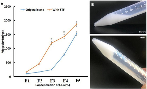 Figure 1 (A) Viscosity for the various GLG formulations (0.1% F1, 0.25% F2, 0.5% F3, 0.75% F4, 1% F5) and for the GLG formulations with STF, simulating the in vivo gelation. (B) Photographs of in situ gels formed before and after (with STF) gelation. *P<0.05. GLG formulations with STF vs GLG formulations without STF.