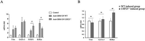 Figure 4. Knockout of USP25 increase transcription of RORγt in vitro (A) and in vitro (B): (A) RORγt mRNA levels in the kidney of USP25−/− mice and wild mice at 14 days at the anti-GBM GN model; (B) CD4 T cells were isolated from the spleen of wild mice and USP25−/− mice, and then induced to Th1, Th2 and Th17 cells. The mRNA levels of RORγt were measured after cell differentiation. Anti-GBM GN, anti-glomerular basement membrane glomerulonephritis; WT: wild type; bars represent means ± SEM; n = 3–4 each group; #p < 0.05; ##p < 0.01.