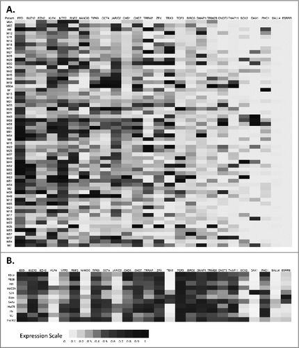 Figure 1. Expression of embryonic stem cell (ESC) genes in CTCL. (A) Lesional skin biopsies were obtained from CTCL patients and gene expression for a panel of ESC genes was analyzed via RT-PCR. (B) Similarly, the expression of ESC genes was also tested by RT-PCR in 11 patient-derived CTCL cell lines cultured under standard conditions.