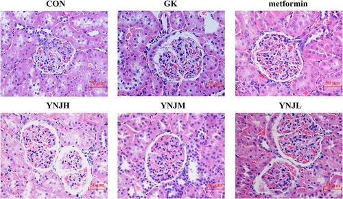 Figure 1 YNJ ameliorated renal cortex injury of diabetes rats detected by HE staining. YNJH (high dose): 12.5 g kg–1d–1 YNJM (medium dose): 6.25g kg–1d–1 YNJL (low dose): 3.125g kg–1d–1.