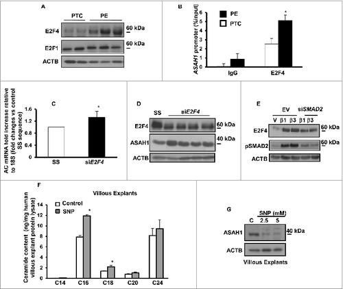 Figure 3. Oxidative stress reduces acid ceramidase expression and impinges on ceramide levels. (A) Representative immunoblots for E2F4 and E2F1 in PE and PTC placentae. (B) ChIP analysis of E2F4 binding to ASAH1 promoter in PE (PE; n = 6 in triplicate) vs. PTC (PTC; n = 6 in triplicate) placentae. Data expressed as % of ASAH1 qPCR of total input DNA; ChIP with nonimmune IgG served as negative control, *P<0.05 vs PTC). (C) AC mRNA expression in E2F4 siRNA-treated JEG3 cells (n = 3, *P<0.05). (D) E2F4 and ASAH1 protein expression in E2F4 siRNA-treated JEG3 cells. (E) Representative immunoblots for E2F4 and phosphorylated pSMAD2 in JEG3 cells following treatment with TGFB1/3 with and without SMAD2 RNAi. (F) Ceramide levels in explants (n = 6 *P<0.05) following SNP exposure. (G) ASAH1 protein expression in villous explants after SNP treatment.