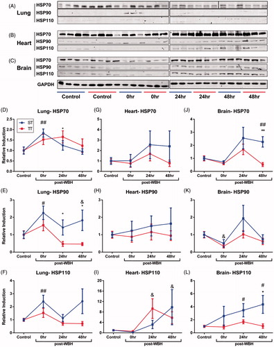 Figure 3. The expression of heat shock proteins is decreased in visceral organs of mice housed at TT compared to mice housed at ST after WBH. (A) Lung, (B) heart, and (C) brain expression of Hsp70, Hsp90 and Hsp110 following 6 h of whole body hyperthermia. (D–L) Fluorescence intensity of heat shock protein expression relative to unheated ST or TT controls. *p < 0.05, **p < 0.01 (ST vs. TT), #p < 0.05, ##p < 0.01 (heated ST vs. unheated ST control), &p < 0.05 (heated TT vs. unheated TT control) by Student’s t-test; n = 3–4 per experiment, each experiment was performed twice and combined.