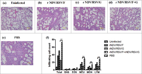 Figure 6. Attenuation of virus-induced lung pathology. After boost immunization with rNDV/RSV/F, rNDV/RSV/G, or rNDV/RSV/F+G, BALB/c mice were challenged i.n. with RSV (1.5 × 106 PFU). Six mice were sacrificed on day 6 after challenge, and lung samples were collected. Histological examination of lung tissues was performed using H&E staining: (A) Normal, (B) rNDV/RSV/F, (C) rNDV/RSV/G, (D) rNDV/RSV/F+G, and (E) PBS. (F) The numbers of inflammatory cells were counted among 100 fields within pathological sections.