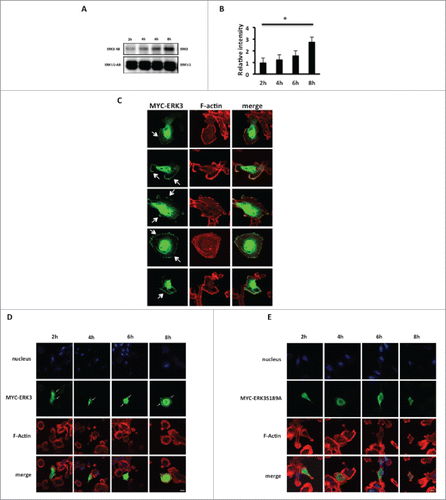 Figure 3. ERK3 increasing level is coincided with the significant decrease of relative spread area. (A) MDA-MB-231 cells were seeded onto collagen I coated six-well plate and harvested at the following time course 2, 4, 6, 8 hours and probe for endogenous ERK3. The figure shown is a representative of three separate experiments. (B) Relative intensity was calculated for the time course blot 2, 4, 6, 8 hours and analyzed using student test. The figure shown is a representative of three separate experiments. (C) Overexpressed ERK3 localizes mainly in the nucleus and at the plasma membrane of the cell. MDA-MB-231 cells were transfected with MYC-ERK3 for 24 hours, fixed and stained with TRITC-phalloidin for F-actin (red) and MYC tag as required (green). (D) MDA-MB-231 cells were transfected with MYC-ERK3 or (E) MYC-ERK3S189A for 24 hours. The transfected cells were then seeded onto collagen I plates for the following time course 2, 4, 6, 8 hours and were fixed and stained with TRITC-phalloidin to show F-actin and Dapi. For ERK3 detection (green), ERK3 monoclonal antibody was used followed by Alexa Flour 488 anti-mouse. Confocal images were taken. Scale bar: 10 μm.