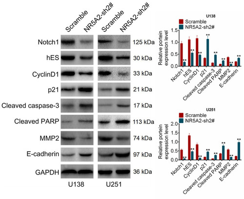 Figure 5 NR5A2 knockdown inhibited Notch signaling pathway activity. The expression levels of Notch signaling pathway-related proteins including NOTCH1, hES, Cyclin D1, p21, cleaved caspase-3, cleaved PARP, MMP2 and E-cadherin were detected using Western blot. Data were shown as mean ±SD. **P<0.01 vs Scramble group.