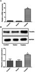 Figure 2 Evaluation of transfection efficiency. (A, B) Transfection of the Tmsb4x overexpression plasmid increased Tβ4 mRNA (A) and protein (B) levels in cortical neurons. Data shown as mean ± SD. *P<0.05 vs control.