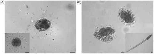 Figure 2. Effects of Ni NPs on the offspring. Representative images of: (A) embryo arrested at different developmental stages and (B) abnormal larvae developed from fertilization performed with sperm exposed to Ni NPs. Insert show (A) normal embryo at the critical stage of eight blastomeres and (B) normal hatched larva. Scale bars are 50 μm.