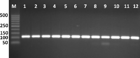 Figure 1. Amplification of Tuf gene producing in Enterococcus isolates by single PCR with size of about 112 bp. First lane is 50 bp molecular weight markers.