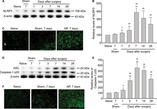 Figure 2 Activation of NLRP3 inflammasome in DRGs of NP-treated rats.
