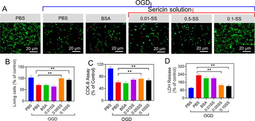 Figure 8. Neuroprotective properties of the sericin oxygen-glucose deprivation (OGD) injury. (A) The neurons were treated with PBS, BSA and the sericin solution (SS) Live and Dead staining. (B) Quantifications of the ratio of live cells. (C) CCK-8 analysis. (D) LDH release.