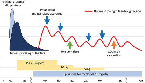 Figure 2. Approximate time course of symptoms and treatments.