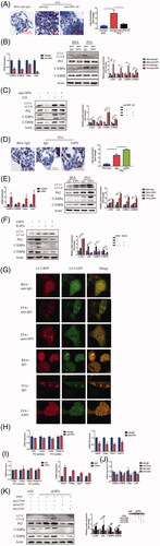 Figure 4. Extracellular OPN exerts its effect on autophagy in FFA-induced HepG2 cells through integrin αVβ3 and integrin αVβ5 containing receptors. (A–C) HepG2 cells were supplemented with BSA or FFA treated with control anti-IgG (40 mg/ml) or anti-OPN Ab (40 mg/ml) for 24 h. (A) Lipid accumulation analyzed by Oil Red O staining and quantitated by image J (scale bars are shown). (B) qRT-PCR analysis of C/EBPα, C/EBPβ, Cidea expand Ly6D gene expression (left panel). Analysis of autophagy-related and lipogenesis-related protein expression (right panel). (C) Analysis of autophagy-related and lipogenesis-related proteins expression in samples from HepG2 cells treated with anti-OPN Ab for 24 h and/or CQ (50 nM). (D-F) HepG2 cells were supplemented with BSA or FFA treated with or without recombinant OPN protein (rOPN) (40 ng/ml) for 24 h. (D) Lipid accumulation analyzed by Oil Red O staining and quantitated by image J. (E) qRT-PCR analysis of C/EBPα, C/EBPβ, Cidea and Ly6D gene expression; Analysis of autophagy-related and lipogenesis-related proteins expression. (F) Analysis of autophagy-related and lipogenesis-related proteins expression in samples from HepG2 cells treated with rOPN for 24 h and/or rapamycin (25 ng/ml). (G) HepG2 cells were cultured in control and FFA with anti-lgG or anti-OPN Ab (upper panel) and lgG or rOPN infected with adenovirus containing mRFP-GFP-LC3-PE (lower panel). Red colour shows autophagolysosomes and double-colour red/green shows autophagosomes. Scale bar, 10 μm. (H) mRNA expression of Fasn and Acaca and the FFA oxidation markers Ppara and Ppargc1a in samples from HepG2 cells treated with control IgG or anti-OPN Ab for 24 h. (I) mRNA expression of Fasn and Acaca and the FFA oxidation markers Ppara and Ppargc1a in samples from HepG2 cells treated with control IgG or rOPN for 24 h. (J) Anti-CD44, anti-αVβ3 or anti-αVβ5 antibody was added to the CM in HepG2 cells supplemented with FFA, and qRT-PCR analysis of C/EBPα, C/EBPβ, Cidea and Ly6D gene expression. (K) HepG2 cells were transfected with siNC or siOPN. Anti-CD44, anti-αVβ3 or anti-αVβ5 antibody was added to the CM respectively, and cell lysates were collected for western blotting to detect indicated proteins. Scale bars are shown. Values are means ± SEM. *p < .05; **p < .01; ***p < .001. All experiments were repeated at least thrice.