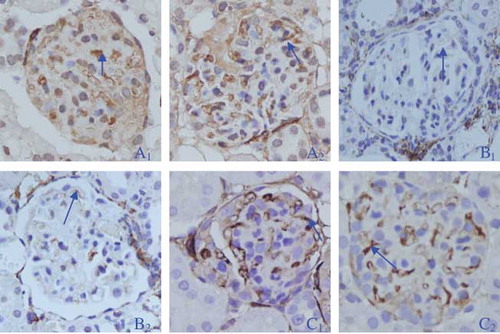 Figure 1.  Representative samples of immunohistochemical staining for PPARγ in glomerulus of rats in the three groups (SHO: A1: 9 weeks, A2: 13 weeks; GS: B1: 9 weeks, B2: 13 weeks; GR: C1: 9 weeks, C2: 13 weeks). The PPARγ was mainly present in glomerular visceral epithelial cells (arrows).Notes: SHO, sham operation group; GS, glomerulosclerosis model group without treatment; GR, glomerulosclerosis model group treated with rosiglitazone. Magnification ×400.